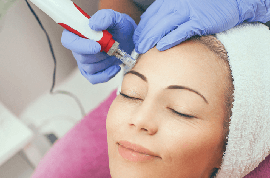 Mesotherapy / Microneedling